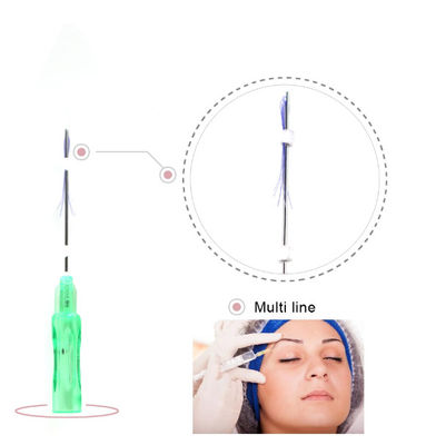 29g 30g 25mm मोल्डिंग पीडीओ थ्रेड लिफ्ट फेशियल बॉडी कोलेजन थ्रेड लिफ्ट