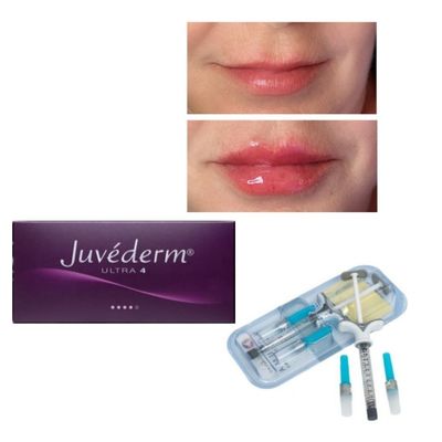 6-9 महीने की अवधि Juvederm Dermal Filler Gel ऑनलाइन और स्टोर में खरीद के लिए
