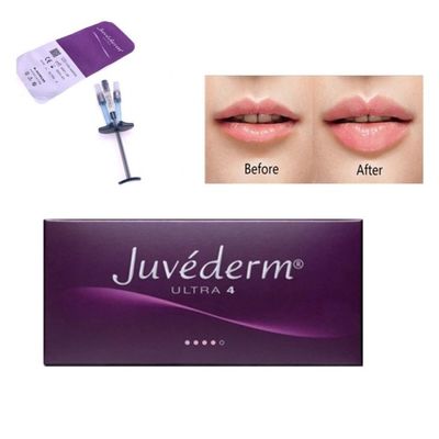 2ml फेस केयर Juvederm क्रॉस लिंक्ड डर्मल फिलर हाइलूरोनिक एसिड इंजेक्शन
