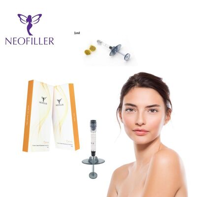 24mg-ml Radiesse Hyaluronic Acid Dermal Filler 0-3% Lido इंजेक्शन योग्य जेल लंबे समय तक चलने वाली चेहरे की झुर्रियों का उपचार
