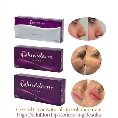 सिरिंज की मात्रा 2 1ml प्रति बॉक्स Juvederm Voluma Filler सुरक्षा चेहरे का आकृतिकरण मात्रा बढ़ाने के लिए इंजेक्शन योग्य त्वचा भराव