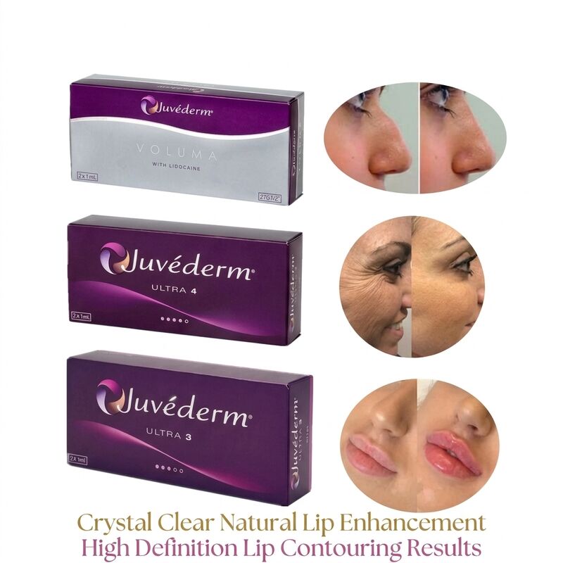 सिरिंज की मात्रा 2 1ml प्रति बॉक्स Juvederm Voluma Filler सुरक्षा चेहरे का आकृतिकरण मात्रा बढ़ाने के लिए इंजेक्शन योग्य त्वचा भराव
